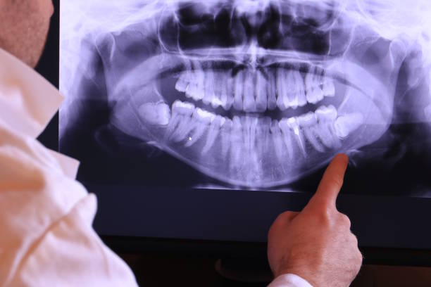 Best Walk-In Emergency Dentist in Yaeyville, NC