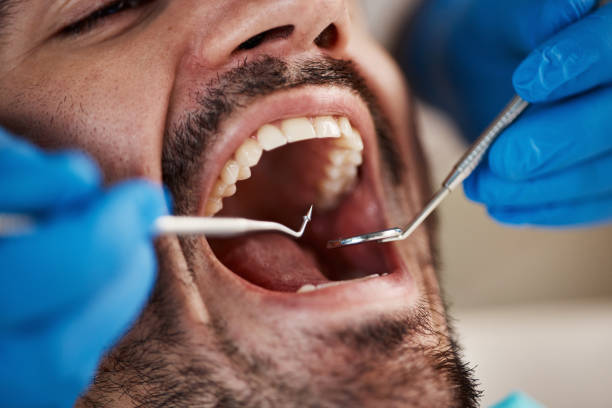 Best Emergency Broken Tooth Repair in Yaeyville, NC